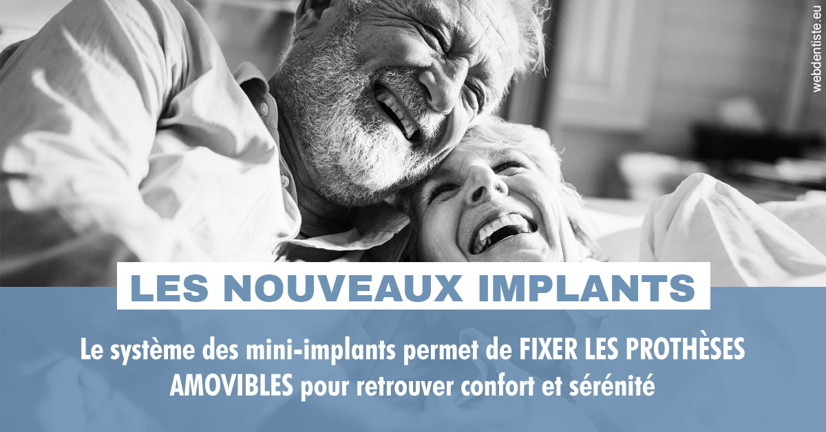 https://dr-pignot-jean-pierre.chirurgiens-dentistes.fr/Les nouveaux implants 2