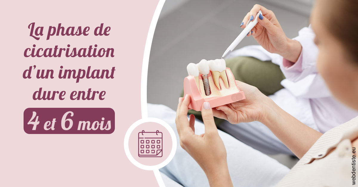 https://dr-pignot-jean-pierre.chirurgiens-dentistes.fr/Cicatrisation implant 2