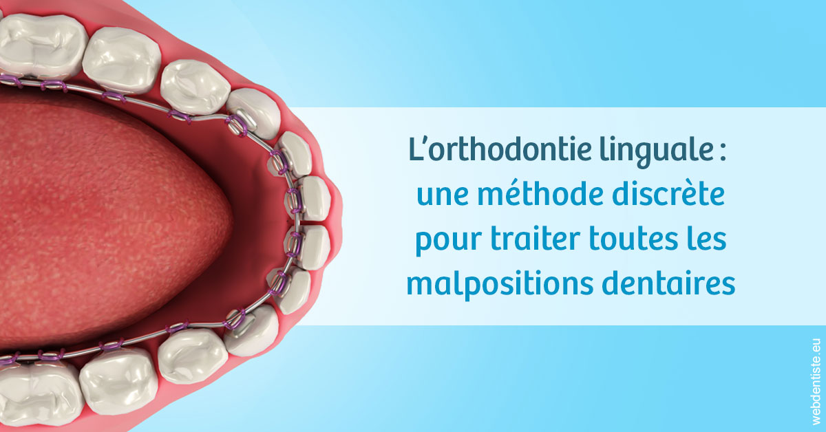 https://dr-pignot-jean-pierre.chirurgiens-dentistes.fr/L'orthodontie linguale 1