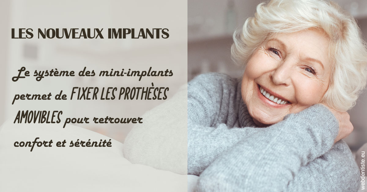 https://dr-pignot-jean-pierre.chirurgiens-dentistes.fr/Les nouveaux implants 1