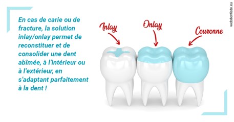 https://dr-pignot-jean-pierre.chirurgiens-dentistes.fr/L'INLAY ou l'ONLAY