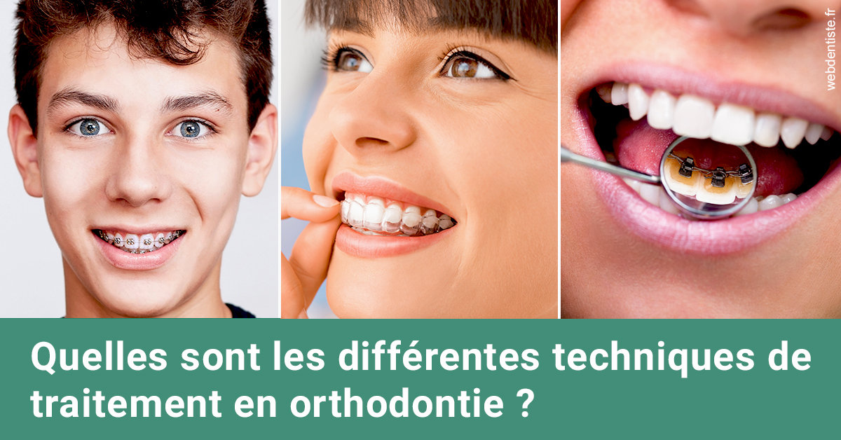 https://dr-pignot-jean-pierre.chirurgiens-dentistes.fr/Les différentes techniques de traitement 2