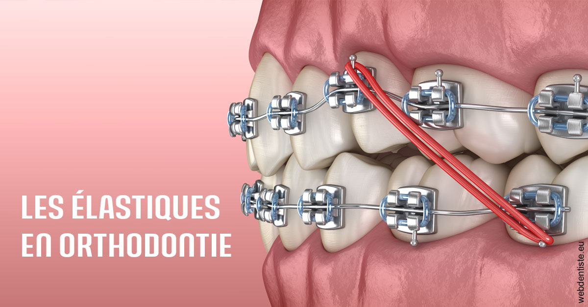 https://dr-pignot-jean-pierre.chirurgiens-dentistes.fr/Elastiques orthodontie 2
