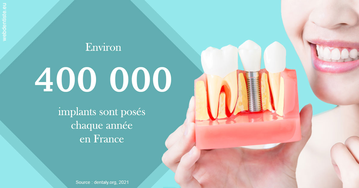 https://dr-pignot-jean-pierre.chirurgiens-dentistes.fr/Pose d'implants en France 2
